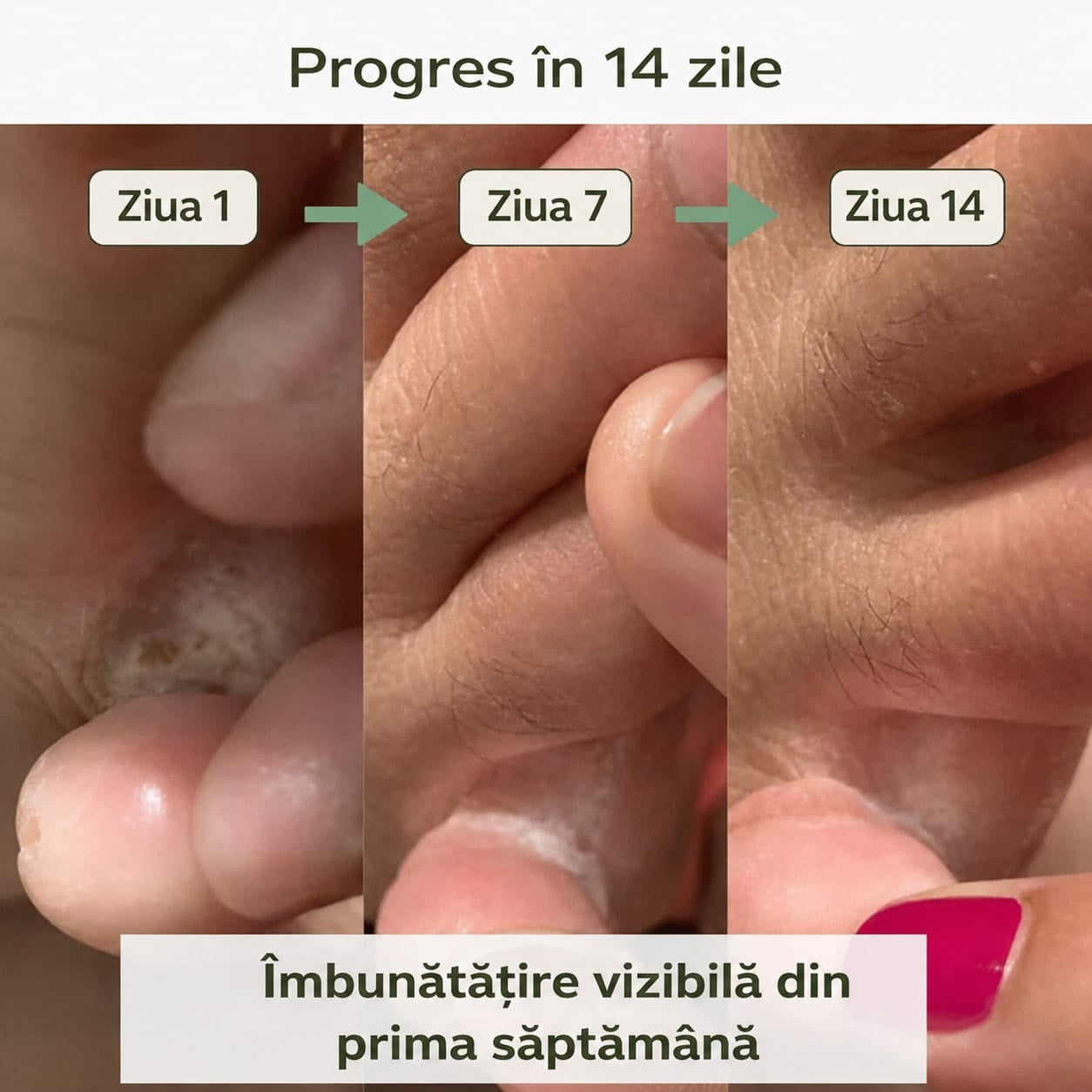 Săpun purifiant antimicotic